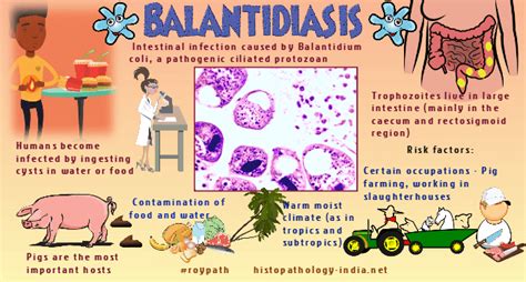 Pathology Of Balantidiasis Balantidium Coli Dr Sampurna Roy Md