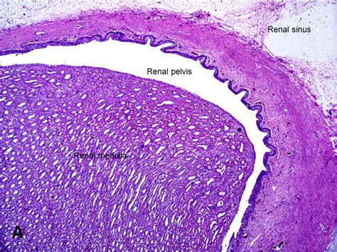 American Urological Association Renal Pelvis And Ureter