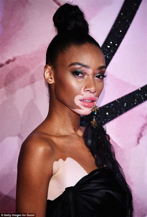 Winnie Harlow Stuns With Thigh High Slit Showing Her Gorgeous Pins