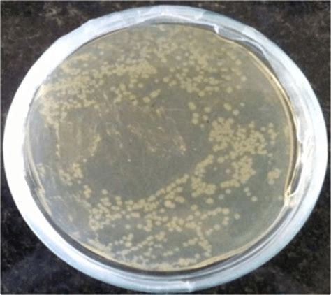 Agar Plate Showing Growth Of Escherichia Coli Bacterial Colonies