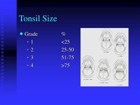 Ppt Tonsillitis Tonsillectomy And Adenoidectomy Powerpoint