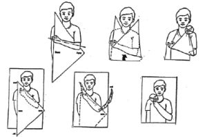 Position patient with the forearm of the injured side across the. Bandages, Knots and Slings | First aid course, First aid ...