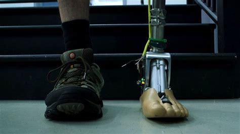 This Smart Prosthetic Ankle Adjusts To Rough Terrain Ankle