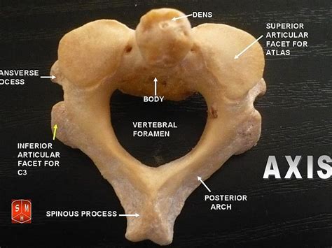 What Is The Difference Between Atlas And Axis Vertebrae Pediaacom