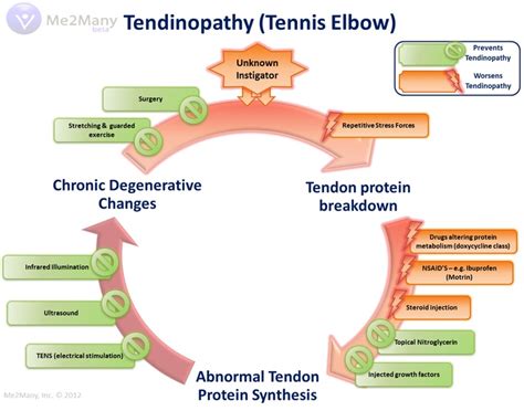 Tennis Elbow Schema Tennis Elbow Trigger Point Massage Protein