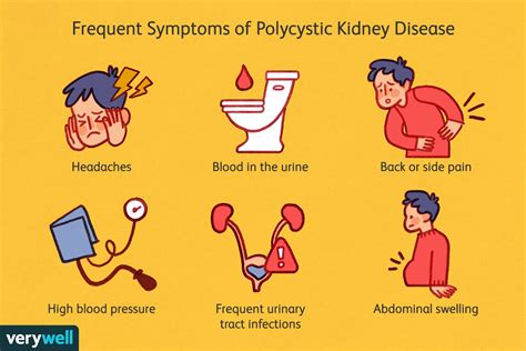 Polycystic Kidney Disease Signs And Symptoms