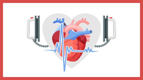 Understanding Heart Failure And Sudden Cardiac Arrest Dr Rajiv