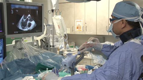 Minimally Invasive Nonsurgical Approach To Repairing Mitral Valve