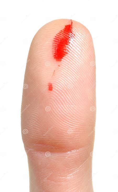 Bleeding From Cut Finger Stock Photo Image Of Pain Hurt 22821112