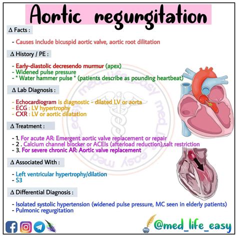 Aortic Regurgitation Flash Card Medical School Life Pediatric