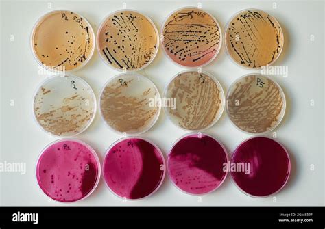 Selective Media Agar Plates With Bacteria Colonies In Various Petri