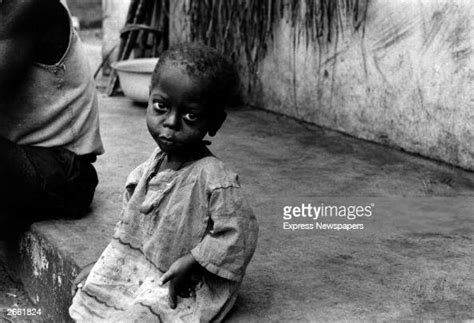 A Starving Biafran Child During The Famine Resulting From The Biafran