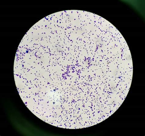 Staphylococcus Epidermidis Stock Photos E Imagens Istock
