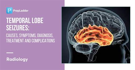 Temporal Lobe Seizures Causes Symptoms Diagnosis Treatment And