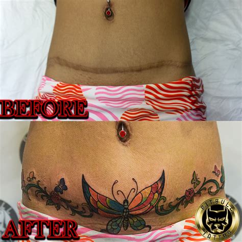 Share More Than 66 Tattoo For Tummy Tuck Scar Best Esthdonghoadian
