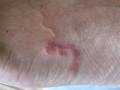 Bicho Geográfico é Perigoso