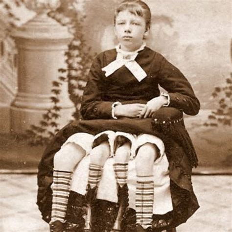 Josephine Myrtle Corbin The 4 Legged Woman Her Story Facts And