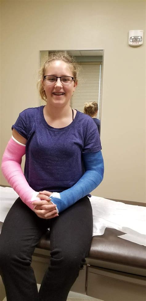 Becca Broke Both Arms 2018 Broken Arm Cast Broken Arm Arm Cast