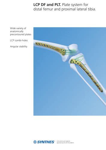 Lcp Distal Femur Promixal Lateral Tibia 45 Depuy Synthes Pdf