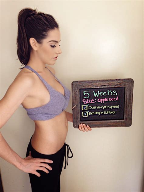 Zack Sydney Ruptured Cyst At Weeks Week Pregnancy Update