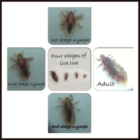 Pin On Clc Lice Control Lessons