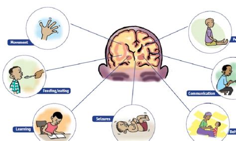 Cerebral palsy (cp) is a neurological condition caused by brain damage and it is the most common motor and movement disability of childhood. Cerebral Palsy: Causes, Signs, Diagnosis & Treatment!