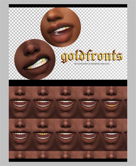 Gold Fronts Teeth Replacment Imsugafoot On Patreon In 2021 Sims 4
