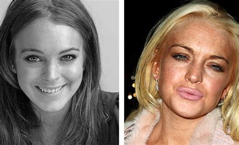15 Famous Drug Addicts Before And After Pictures New