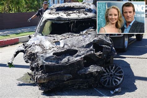 In A Fiery Car Crash In Mar Vista Actress Anne Heche Was Badly Injured