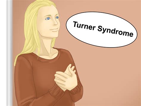 How To Diagnose Turner Syndrome 11 Steps With Pictures