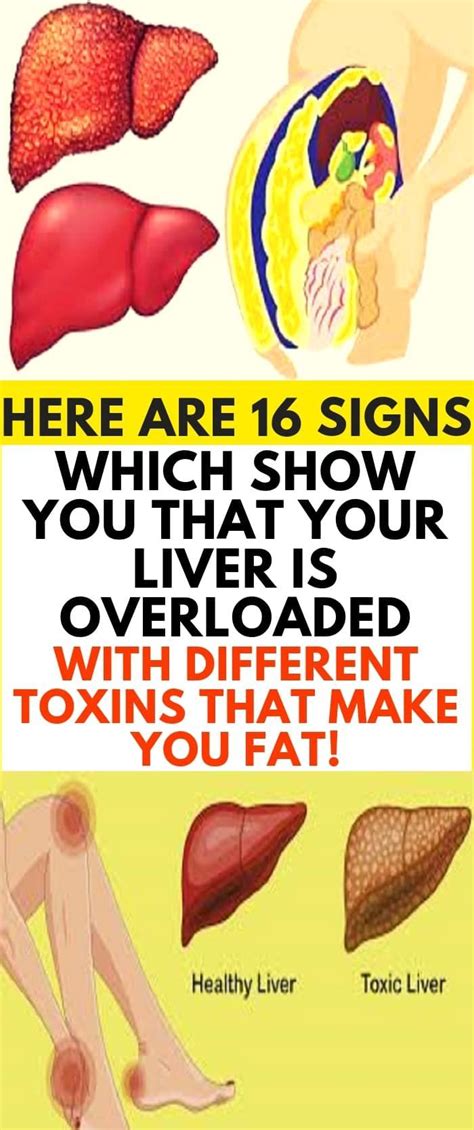 Pin On Liver Cleanse Detox