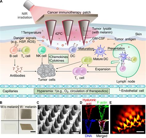 A Melanin Mediated Cancer Immunotherapy Patch Science Immunology