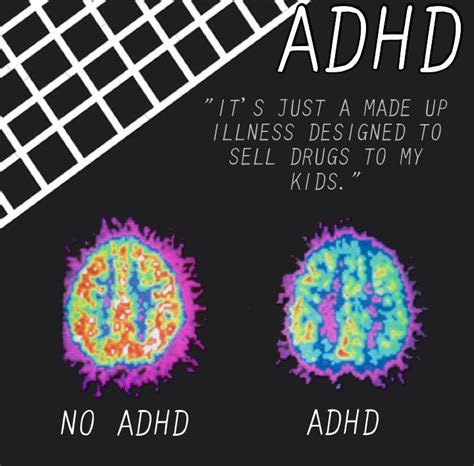 Read this to (finally!) grasp why add symptoms impact your emotions and behavior in the way they do. depression ADHD OCD mental illness PTSD mental health ...