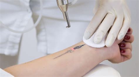 Ways To Take Care Of Your Skin After A Laser Tattoo Removal Live Enhanced