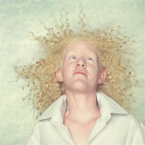 Albinos L Absence De Couleur Sublim E Par Gustavo Lacerda Albinism