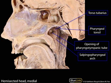 S12 Pterygopalatine Fossa And Palate Learning Objectives Bluelink