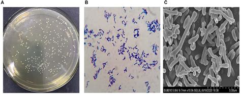 Bifidobacterium Gram Stain