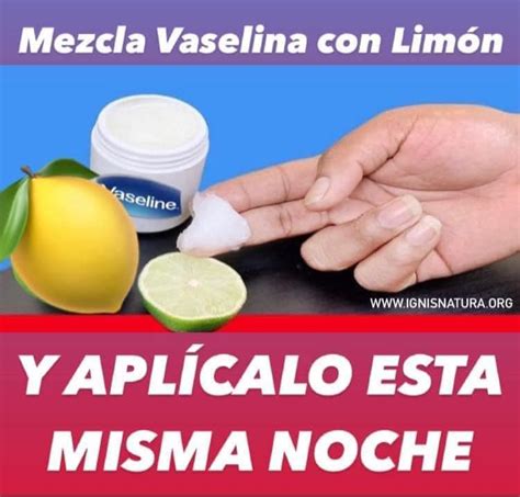 Así Se Usa La Vaselina Con Limón Para Convertir Tu Cara Como La De Una