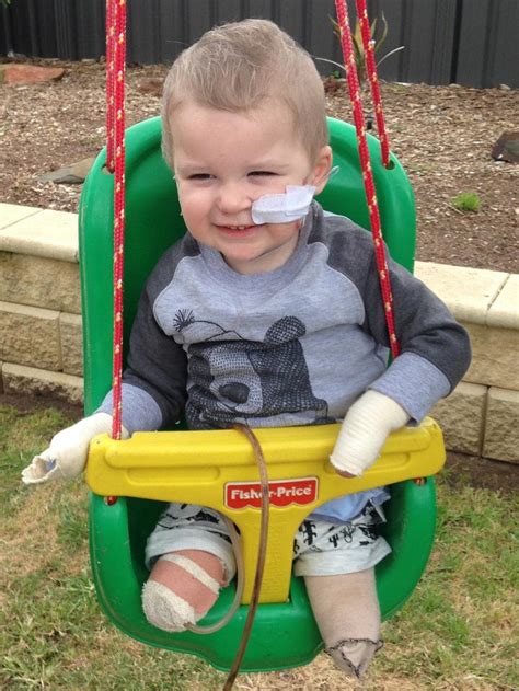 Brave Riley Wins His Fight With Meningococcal As W Strain Resurgence
