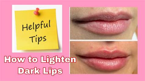 How To Lighten Dark Lips Naturally I By Madam M Youtube