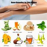 Different Types Of Home Remedies