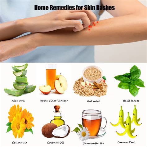 Natural Remedies For Skin Rash Naturalskins