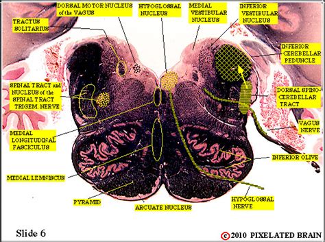Pixelated Brain Module 12 Section 3 The Vestibular System