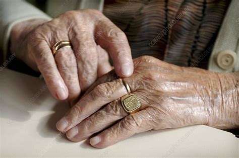 Elderly Womans Hands Stock Image C0076528 Science Photo Library