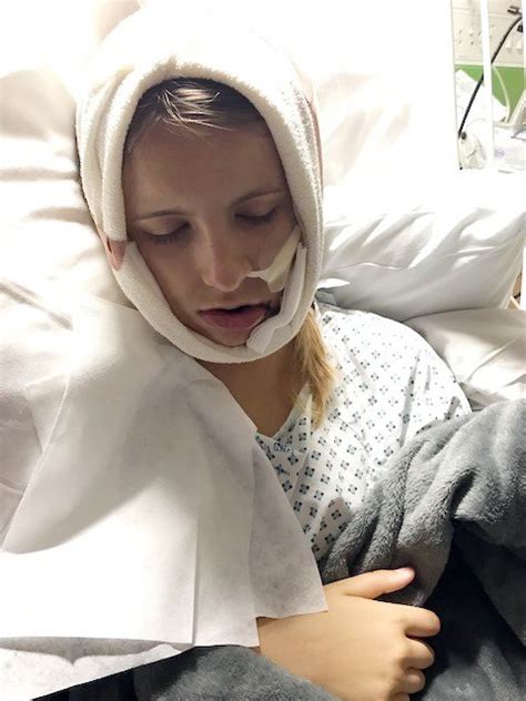 Teen Caught Own Jaw When It Was Ripped Off In Riding Accident Metro News