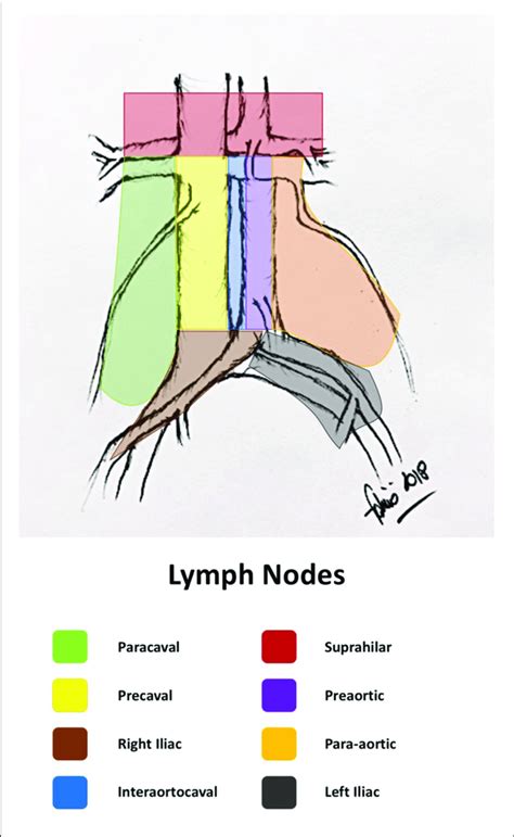 Retroperitoneal Lymph Node Areas Original Drawing By The Author