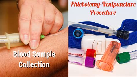 Phlebotomy Venipuncture Procedure I Safe And Effective Blood Draw