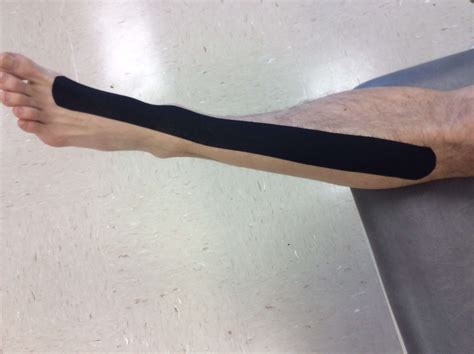 Kinesiology Tape For Shin Splints