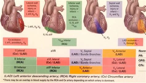 12 Lead Life Safety Solutions Arteries Anatomy Cardiac Nursing
