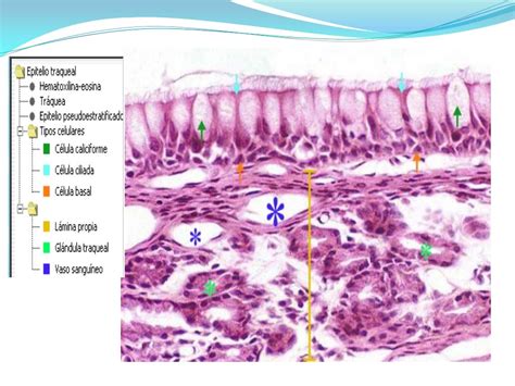 Epitélio Respiratório Histologia